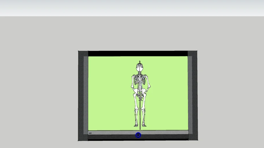 X-Ray machine with gruesome impaled skeleton